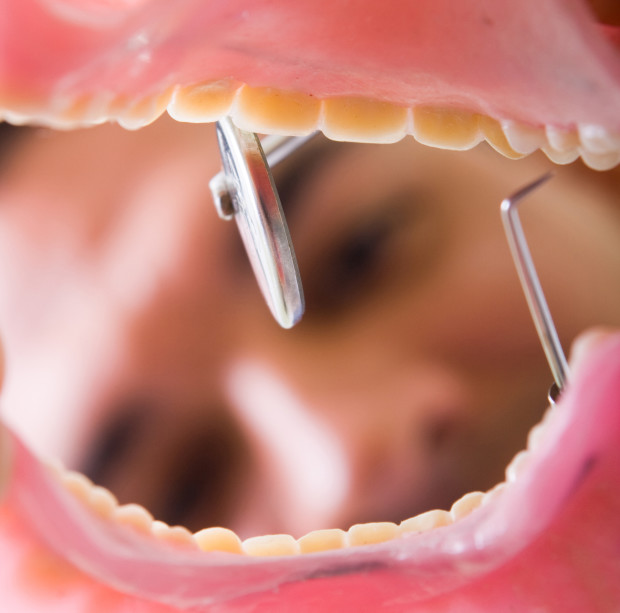 A view from inside the mouth. A dentist is checking the gums before the LANAP procedure and using stem cells for healing.